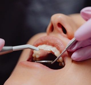 Why Regular Dental Check-Ups Matter