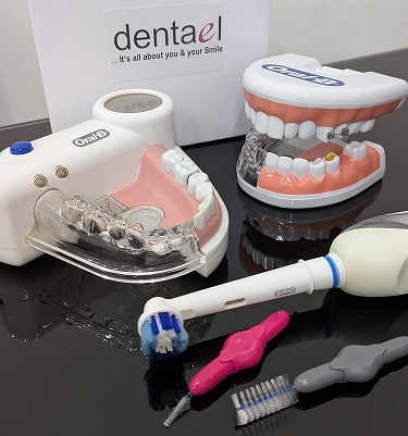 Dentael FAQs