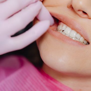 Missing tooth replacement