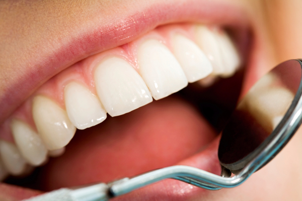 Why Preventive Dental Care Matters