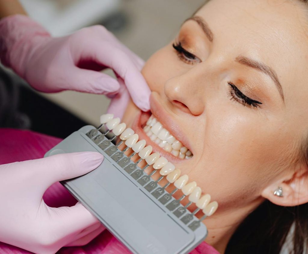 How professional teeth whitening works
