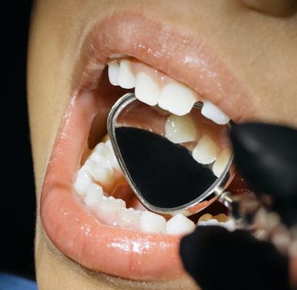 Tooth Decay : What is it?