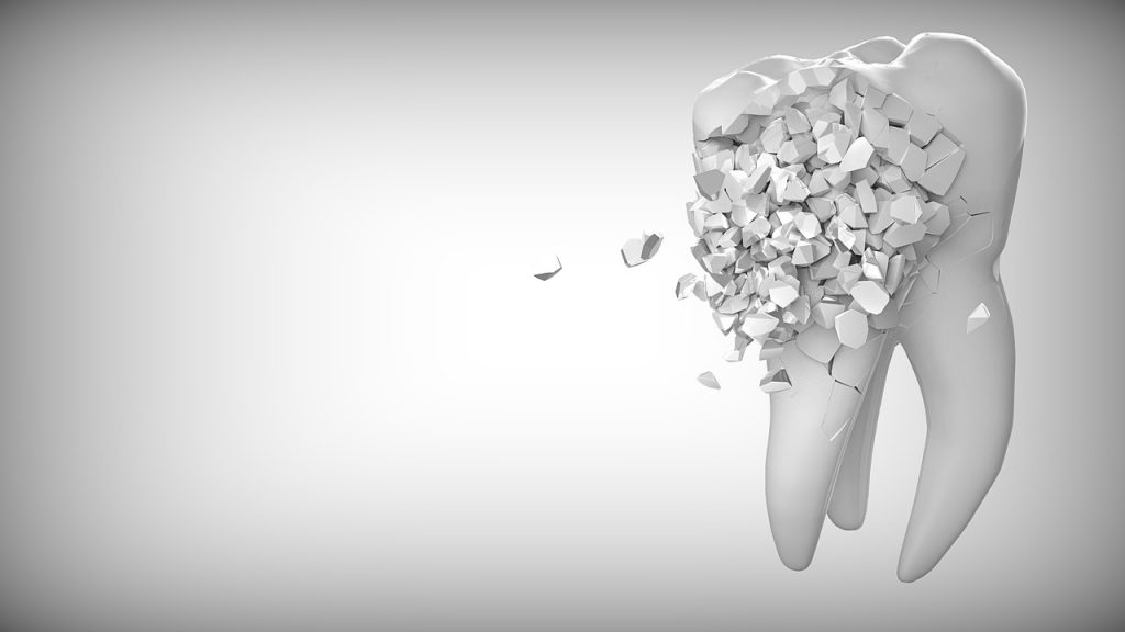 Tooth Erosion Causes and Treatments