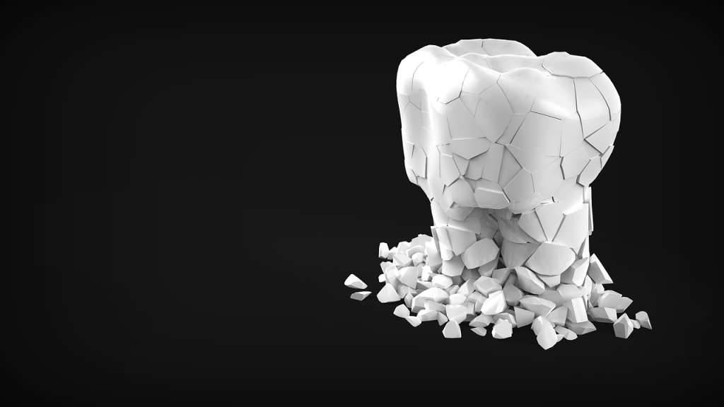 Worn Teeth Treatments
